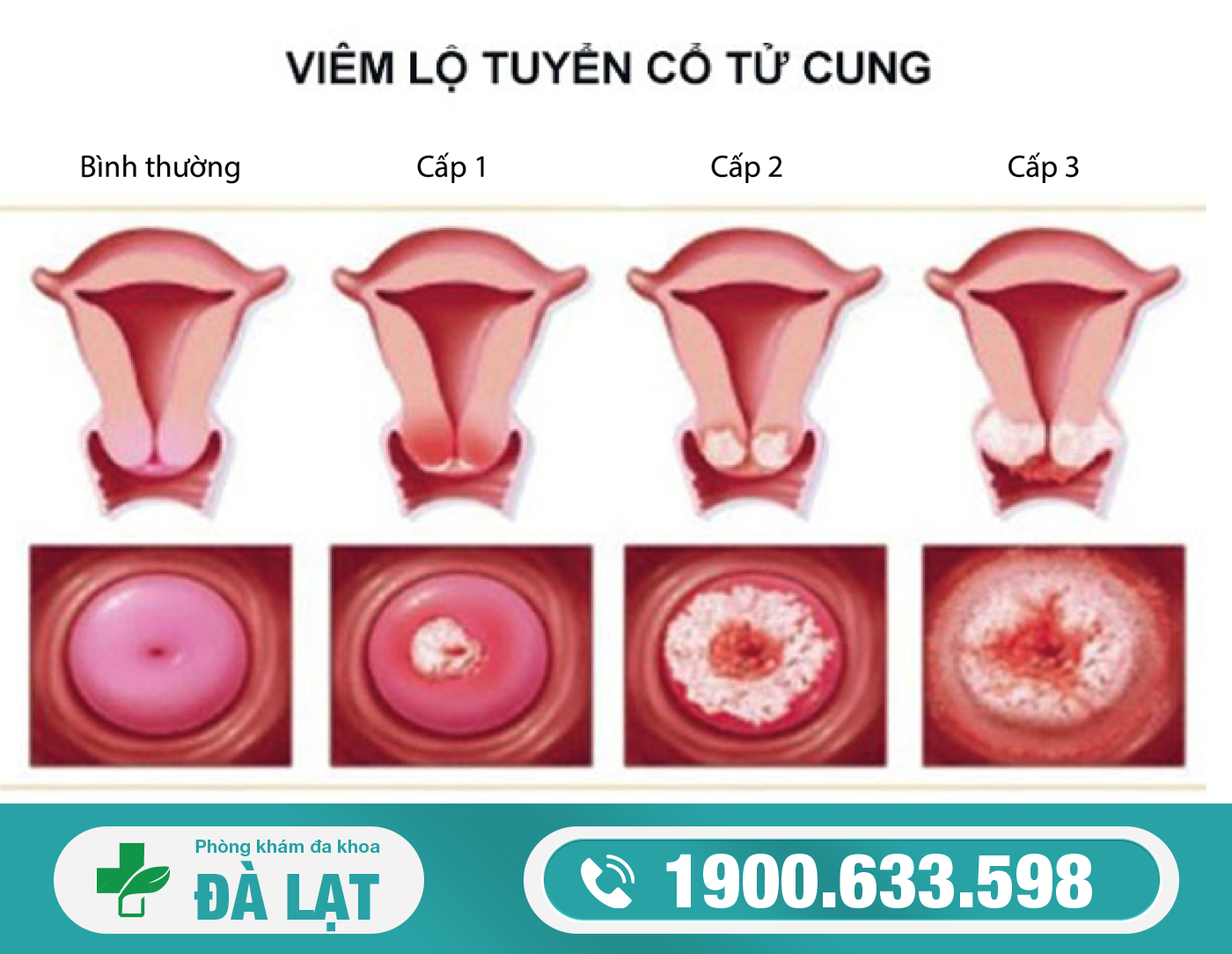 Hình ảnh minh họa